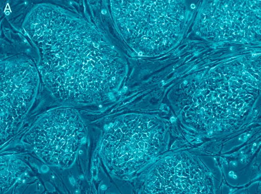 Como maximizar os benefícios da sua Terapia com Células-Tronco
