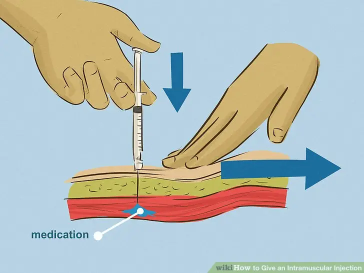 Injeção intramuscular